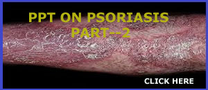 PPT ON  PSORIASIS PART-2